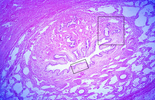  penis, corpus spongiosum 