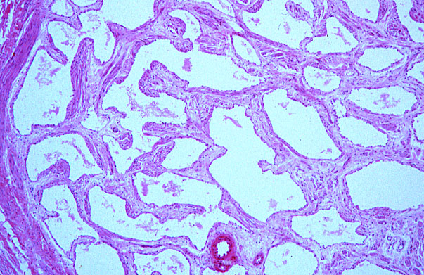  penis, erectile tissue 