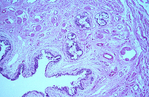  penis, glands of Littré 