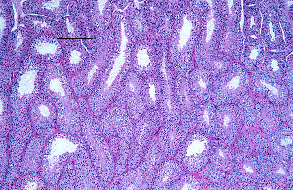  testis, seminiferous tubules 