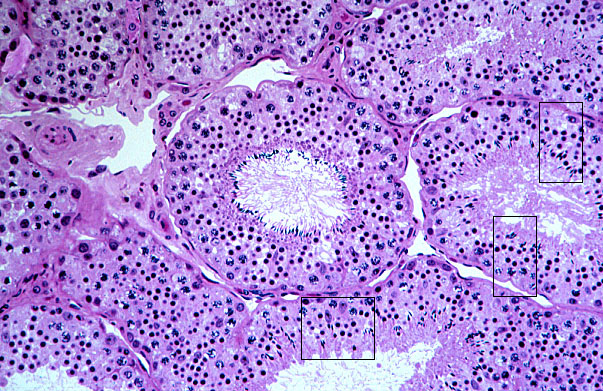  testis, germinal epithelium 