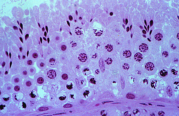  testis, late spermatids 