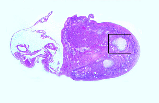  ovary, atretic follicles 