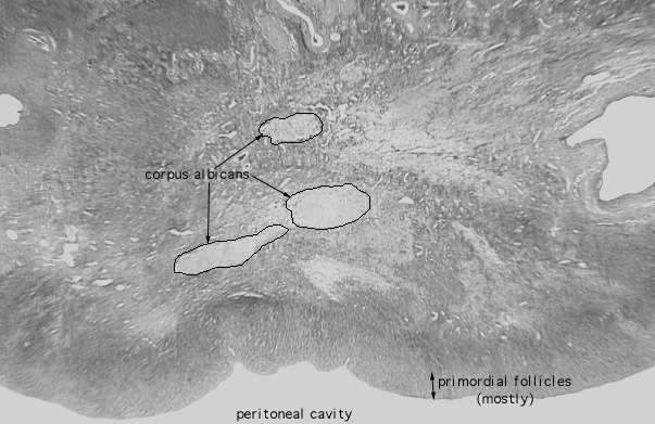  ovary, corpus albicans 
