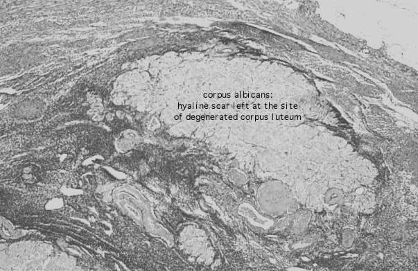 ovary, corpus albicans 