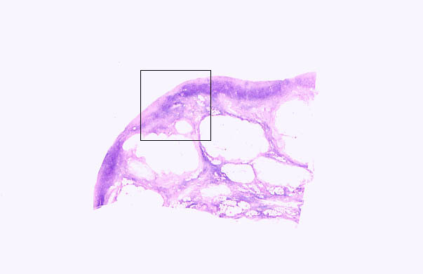  ovary, corpus albicans 