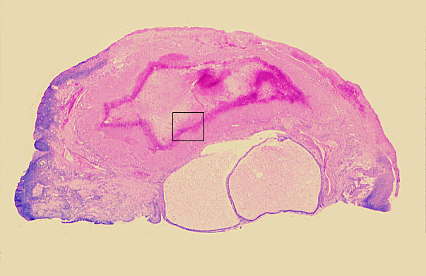  ovary, corpus luteum 