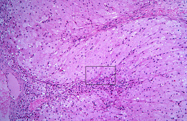  ovary, corpus luteum 