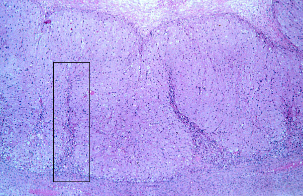  ovary, corpus luteum 