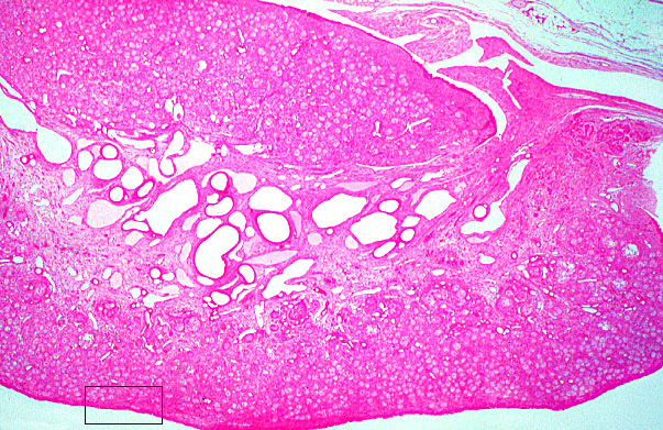  ovary, medulla and cortex 