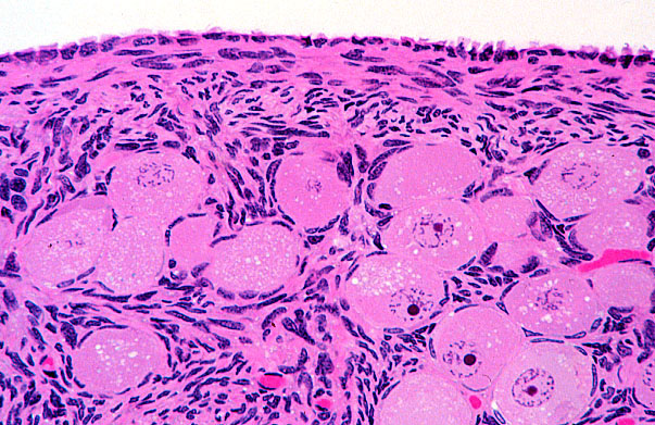  ovary, germinal epithelium and primordial follicles 