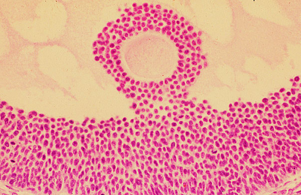  ovary, cumulus oophorus 