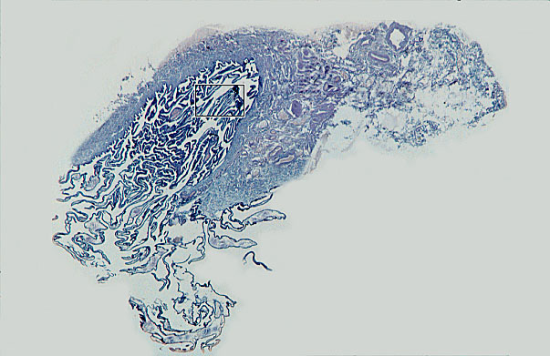  oviduct; infundibulum and fimbria 