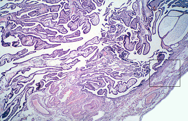  oviduct; infundibulum 