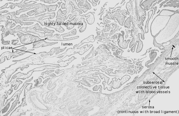  oviduct; infundibulum 