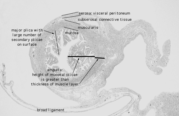  oviduct; ampulla 