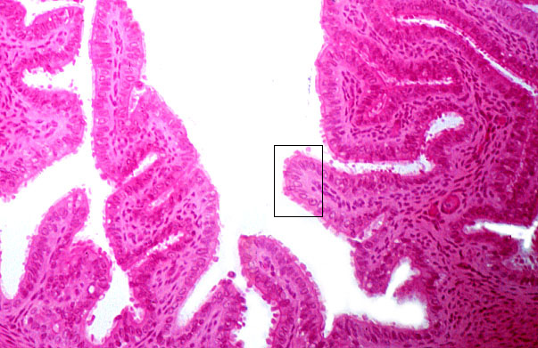  oviduct; ampulla, mucosa 