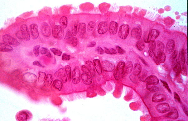  oviduct; ampulla, epithelium 