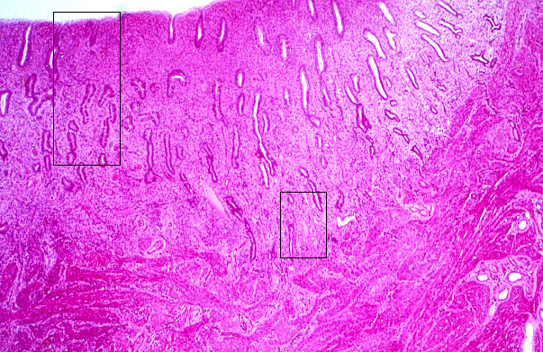  uterus, proliferative 
