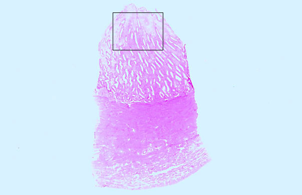  uterus, proliferative 