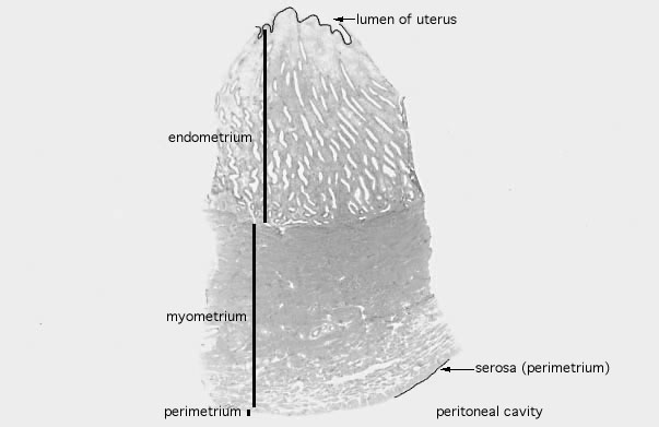  uterus, proliferative 