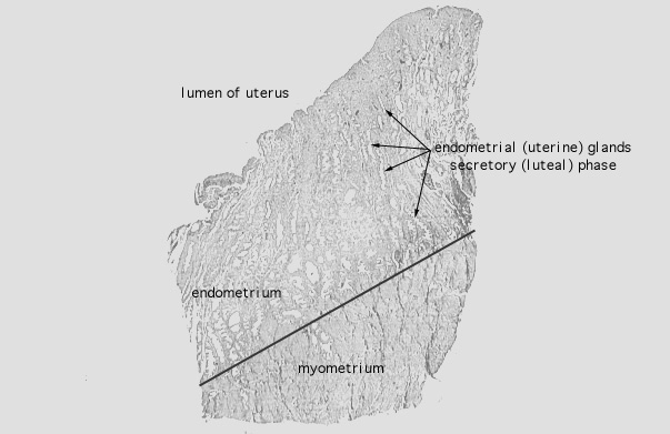  uterus, secretory 