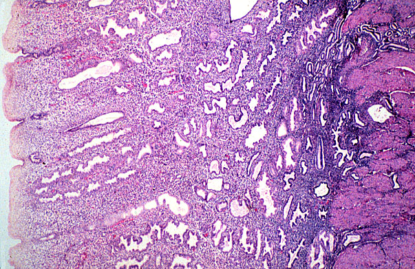  uterus, early secretory 