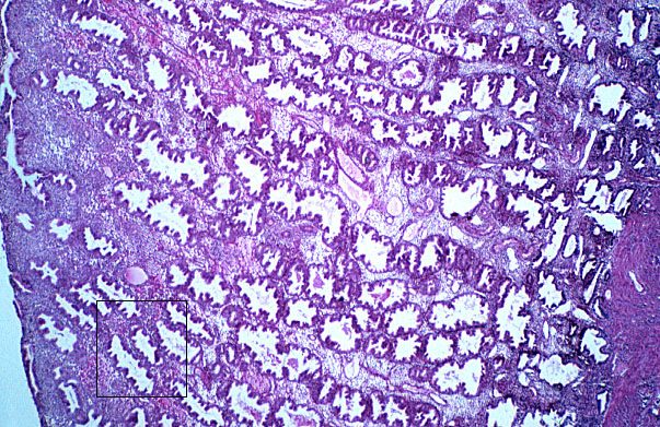  uterus, late secretory 