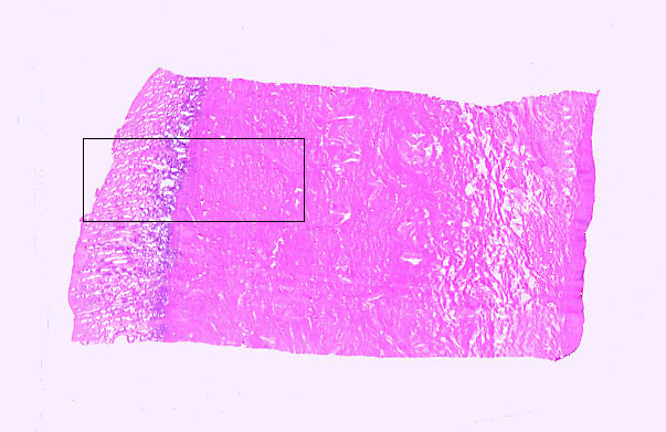  uterus, secretory 