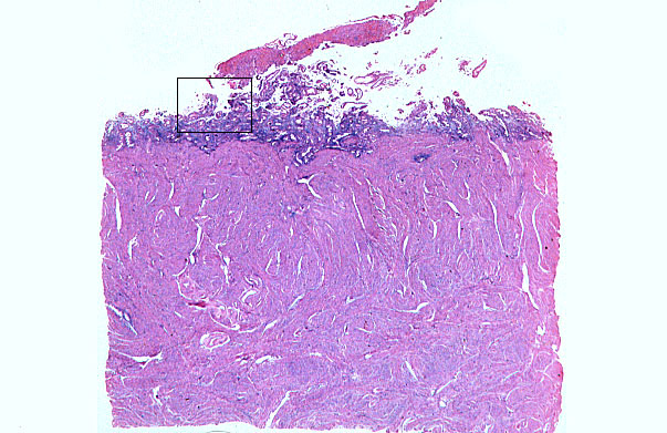  uterus, menstrual 