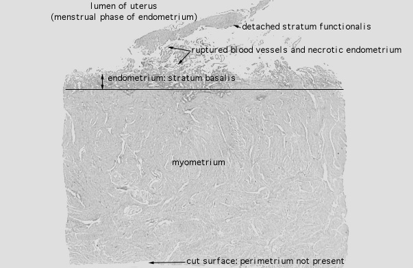  uterus, menstrual 