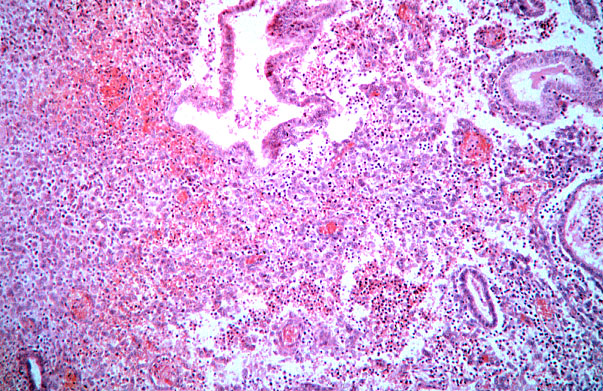  uterus, menstrual, endometrium 