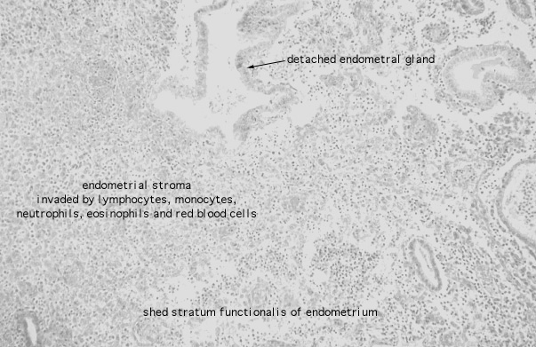  uterus, menstrual, endometrium 
