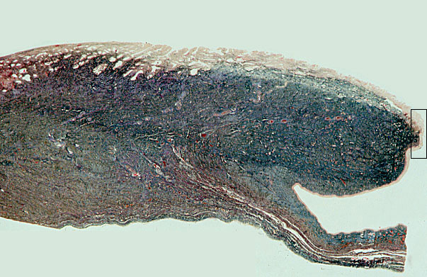  cervix, longitudinal 