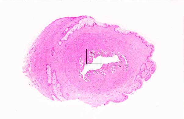  cervix, transverse 