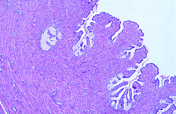  cervix, transverse, plicae palmitae 