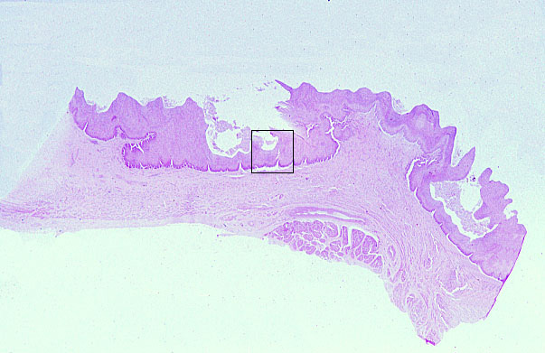  stratified squamous, non/keratinized epithelium 