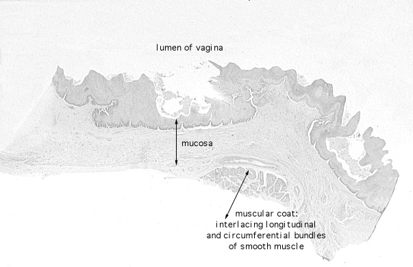  vagina 