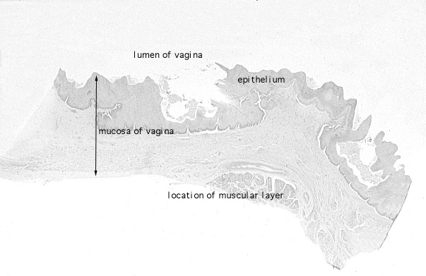  stratified squamous, non/keratinized epithelium 