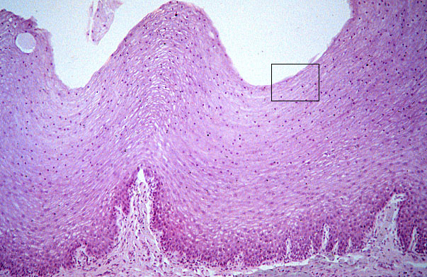  stratified squamous, non/keratinized epithelium 