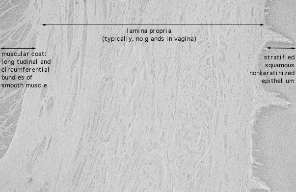  vagina 