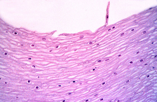  stratified squamous, non/keratinized epithelium 