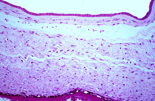 placenta, chorionic plate 