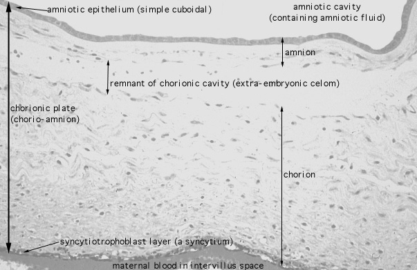  placenta, chorionic plate 