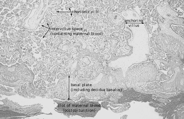  placenta, basal plate 