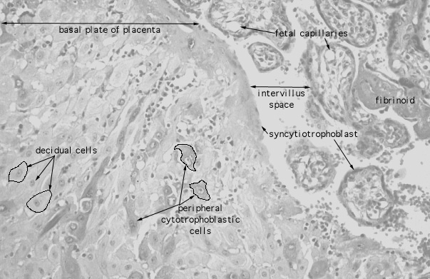  placenta, decidual cells 