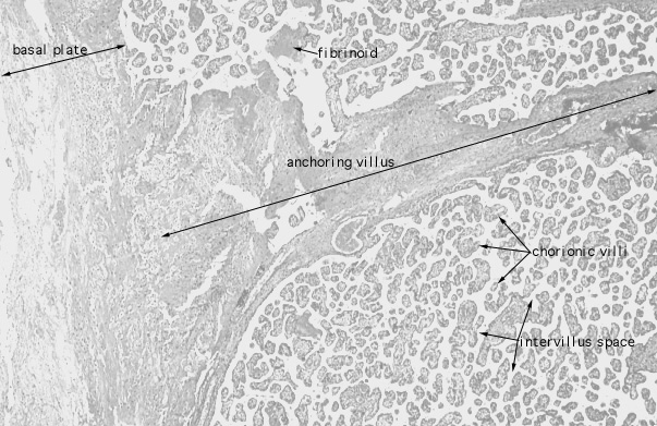  placenta, anchoring villus 
