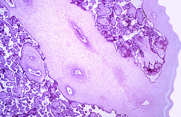  placenta, stem villus 