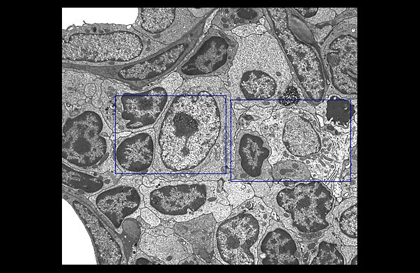  nuclear morphologies 
