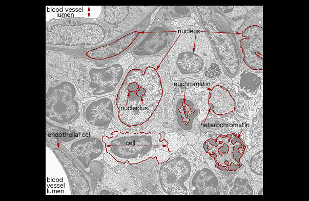  nuclear morphologies 